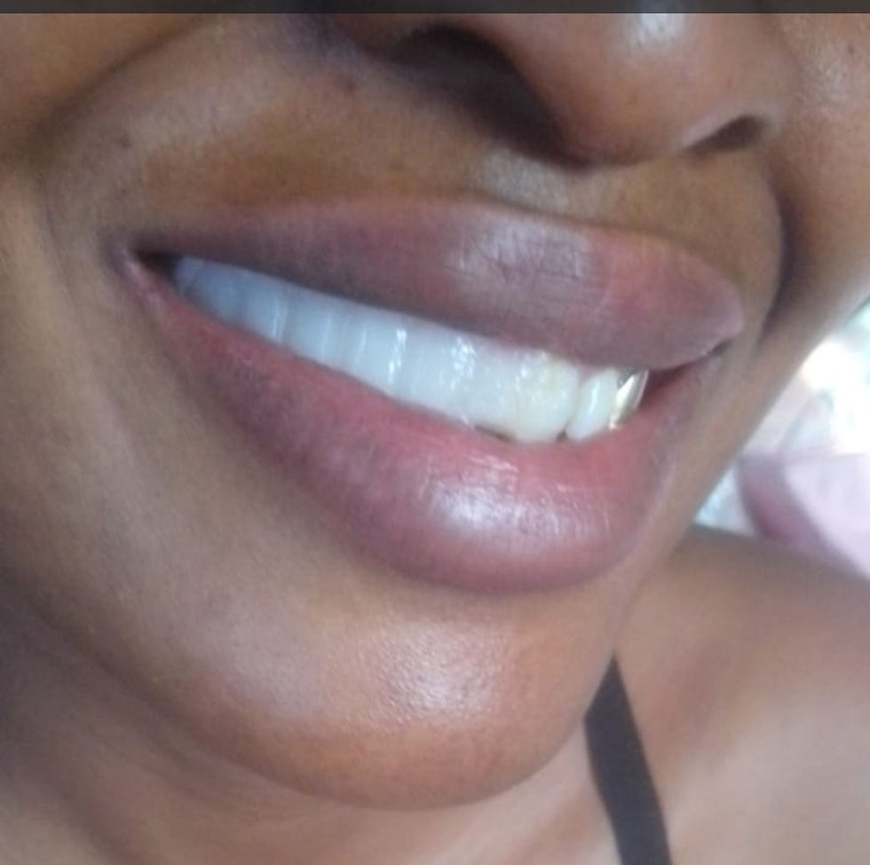 Thumbnail: Magic smile emergency tooth kits 