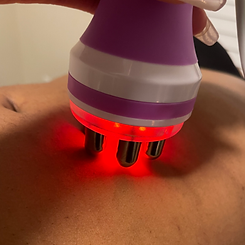Radiofrequency Body Contouring Bodies of Atlanta