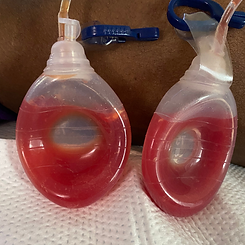 Drain Removal Post-Op Care Bodies of Atlanta
