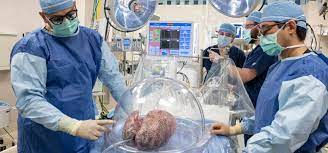 Residency Surgery Personal Statement, Cardiothoracic