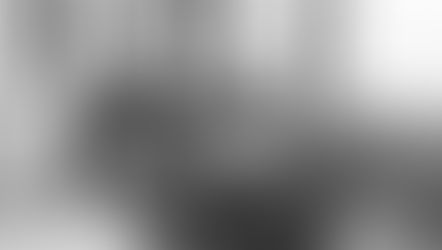 SLP Statement of Purpose Examples Editing | Personal Statement Writing Service