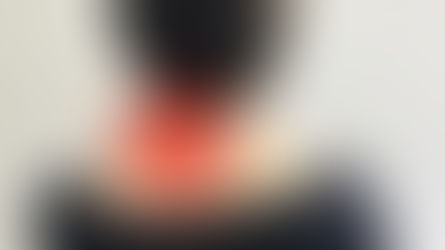 交通事故後の「首の付け根・後頭部」のズーンとした重だるさ|安佐南区 交通事故 首の付け根 後頭部 痛み