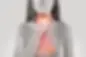 Acid-Reflux.webp