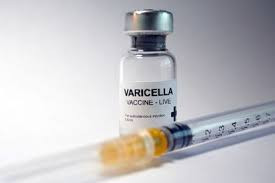 Vacuna para Varicela