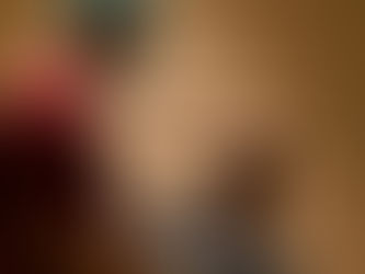 Homens morrem depois de fazerem transplante de cabelo com dentista