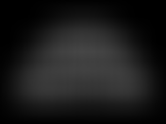 Patinetes Elétricos: Cianorte está esperando morrer alguém para tomar uma atitude... 