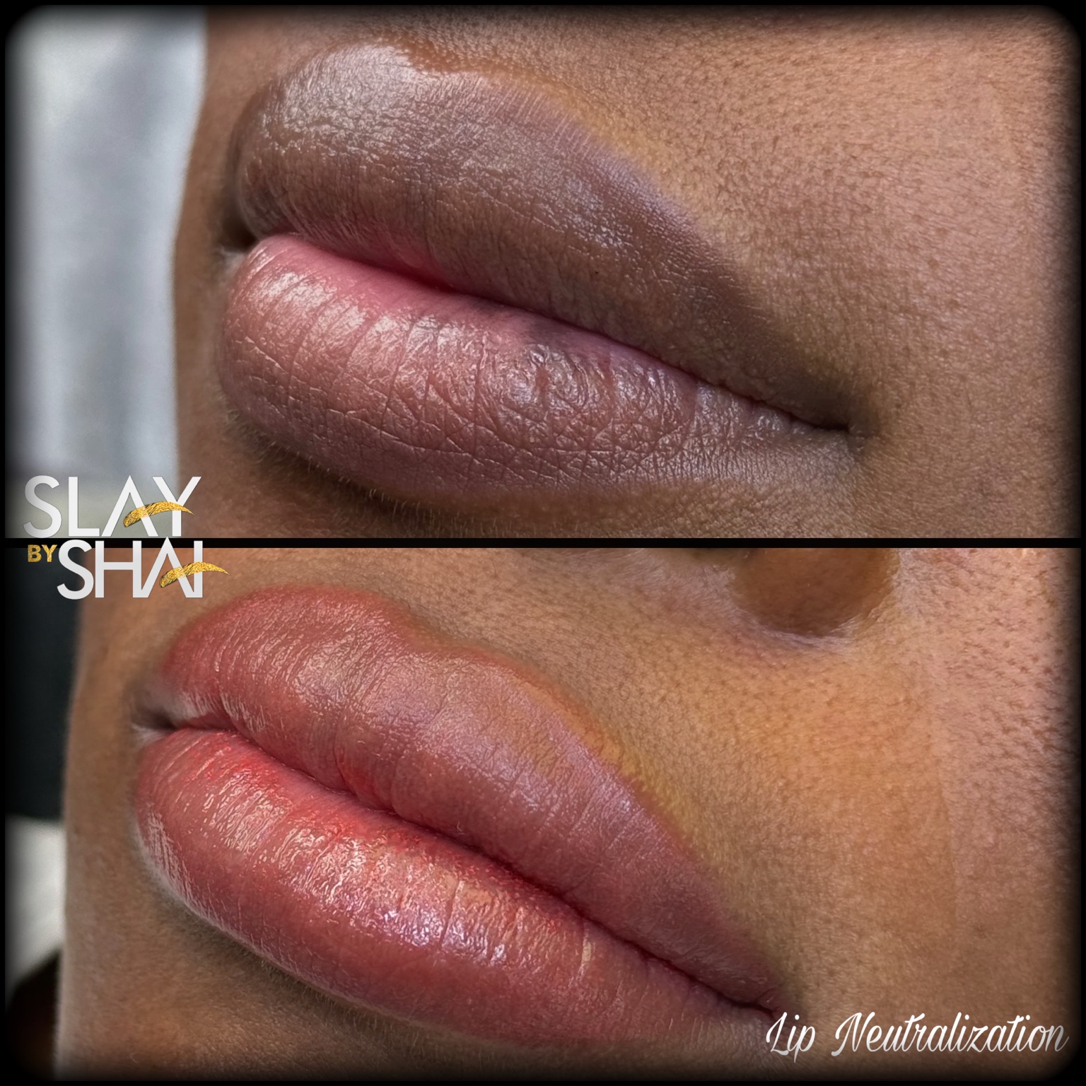 Original client lip neutralization result — example 6