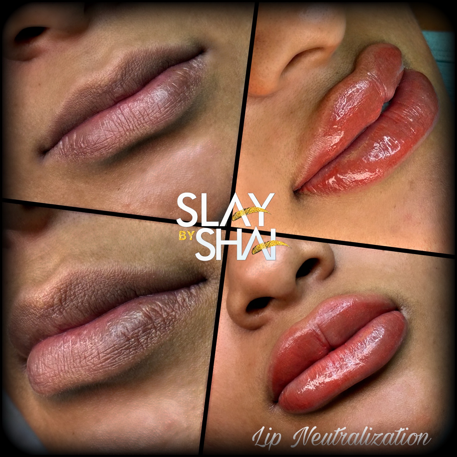 Original client lip neutralization result — example 2