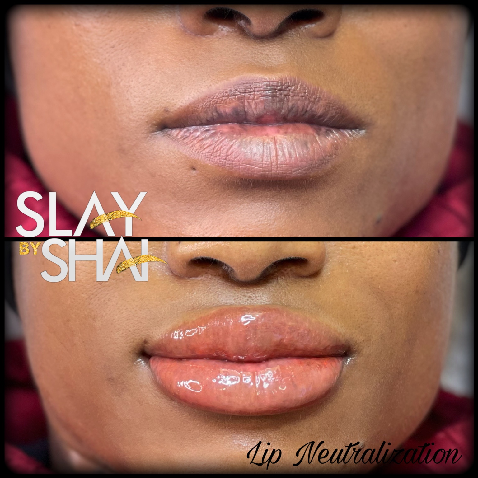 Original client lip neutralization result — example 9