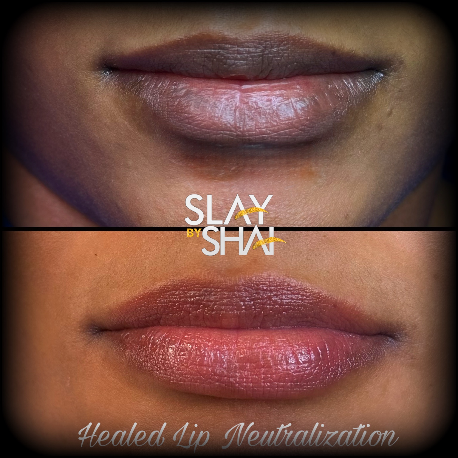 Original client lip neutralization result — example 10