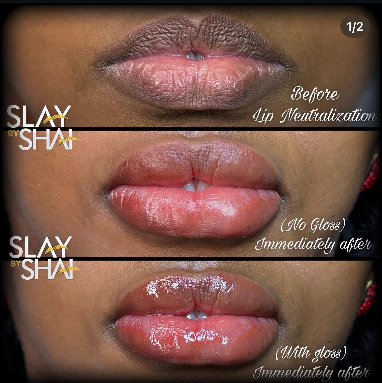 Original client lip neutralization result — example 7