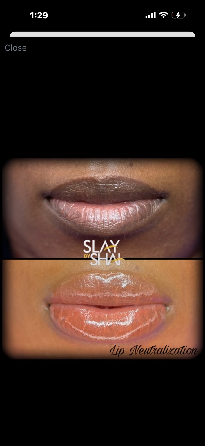 Original client lip neutralization result — example 8