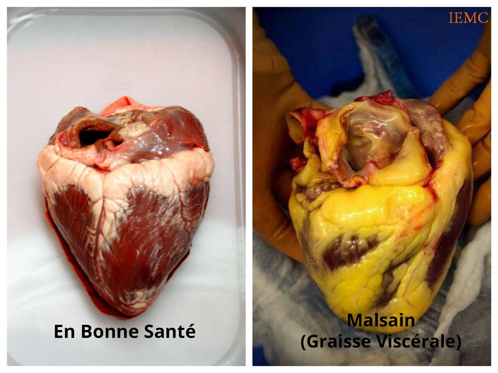 Résultat de recherche d'images pour "coeur graisse"