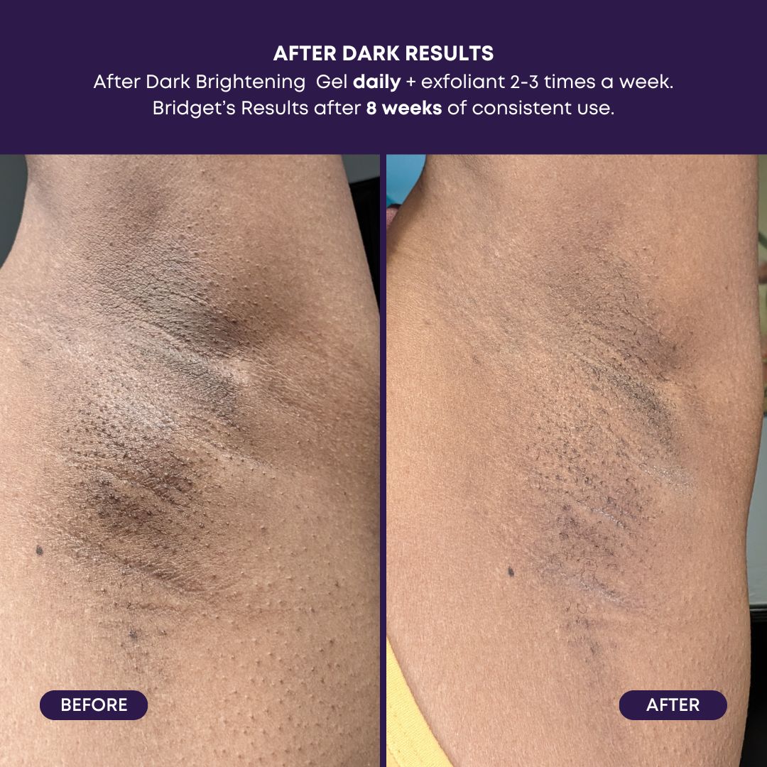 After Dark Brightening Gel – Image 4