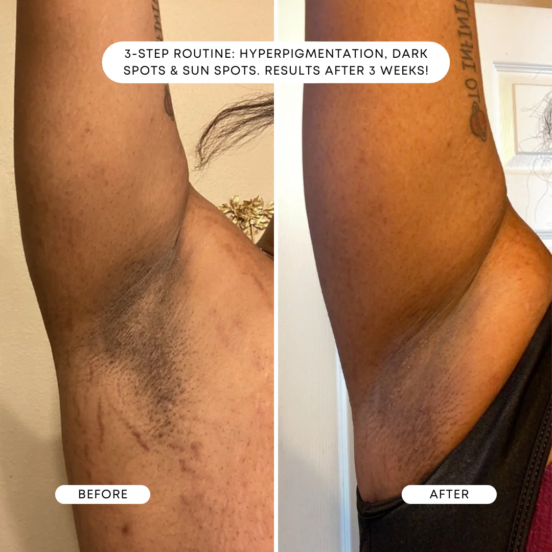 Bermuda Dark Spot Oil – Image 5