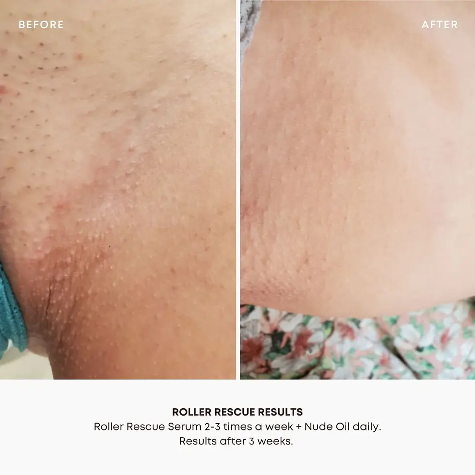 Thumbnail: Roller Rescue Soothing Serum