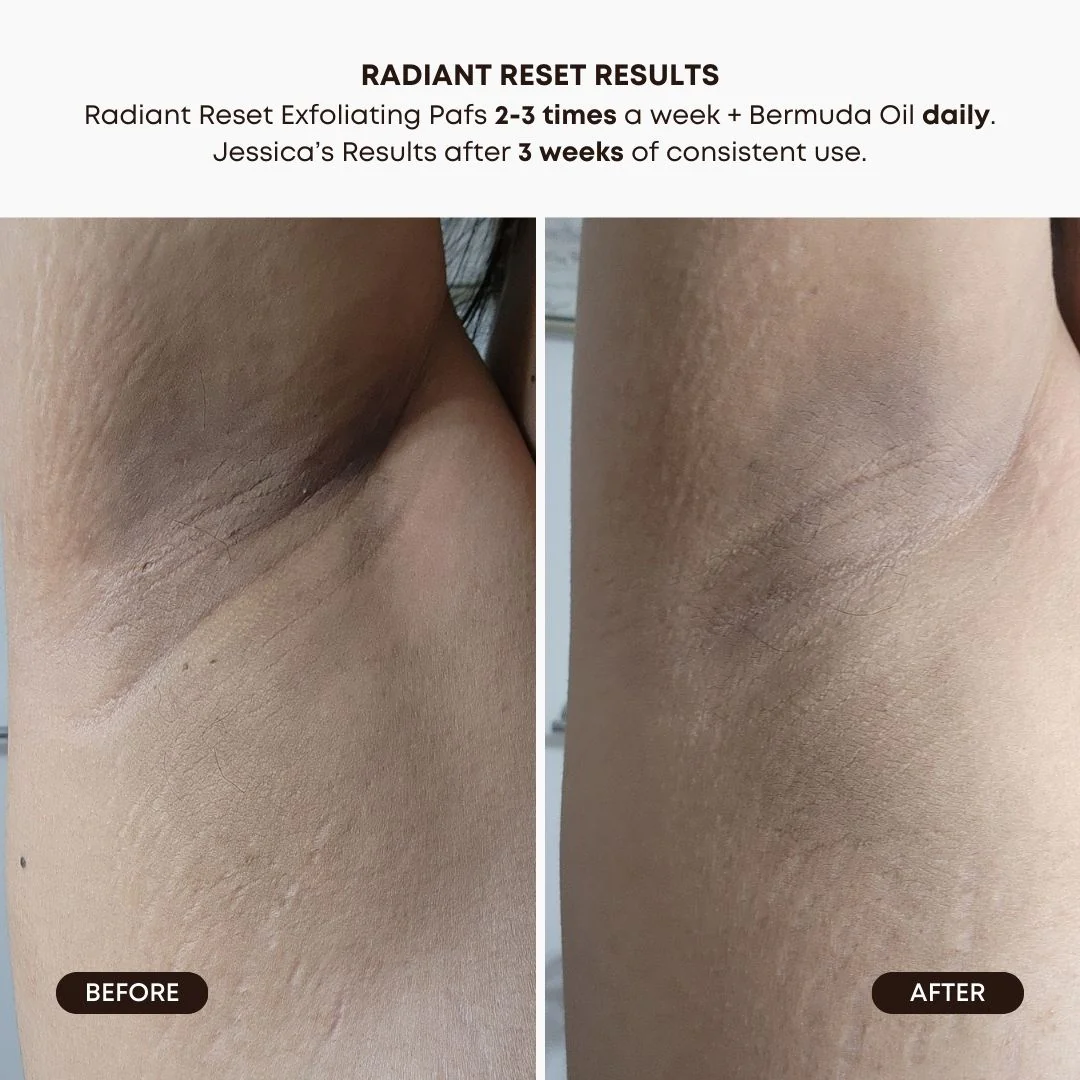 Radiant Reset Exfoliating Toner Pads – Image 3