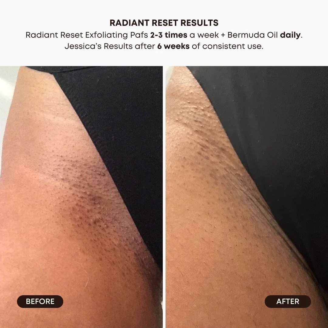 Radiant Reset Exfoliating Toner Pads – Image 4