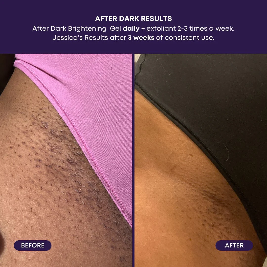 After Dark Brightening Gel – Image 5