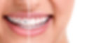 ortodoncia ube dental Metepec