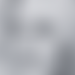 Get Tighter Looking Skin with our Fat Transfer Procedure