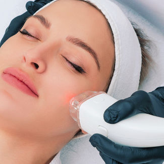 Woman receiving facial treatment with a white laser device. She has a relaxed expression, wearing a headband. Black gloved hands hold the device.