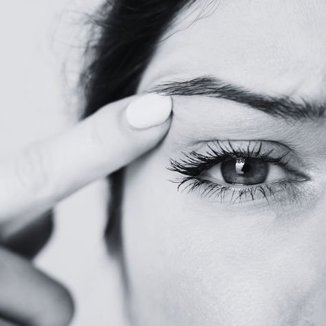 Droopy Eyelids and Revisional Eyelid Ptosis Surgery