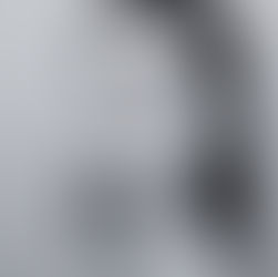 How We Treat Keloid, Acne and Hypertrophic Scars