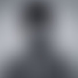 Types and Benefits of Facial Fillers