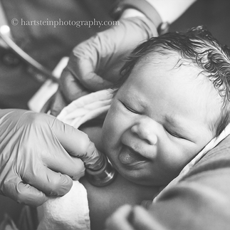 A newborn baby being monitored