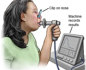 Pulmonary Function Tests: Understanding How Well Your Lungs Work