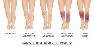 Business opportunity in health care ( VENOUS DISEASES ) is now looking to expand into your country