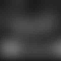 Panoramic X-ray showing six dental implants in the upper jaw and natural teeth with restorations in the lower jaw.