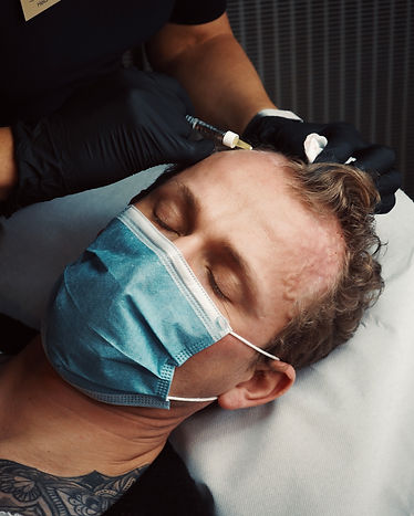 Hairfiller mod uønsket hårtab