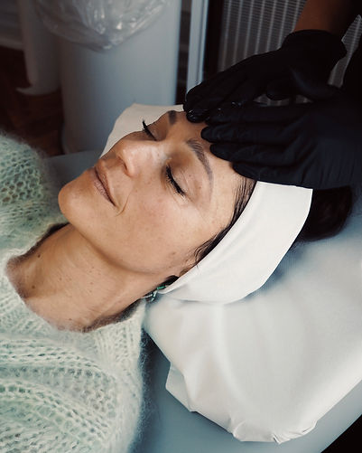 Behandling med PRX peeling til hudfornyelse og forøget glød og vitalitet