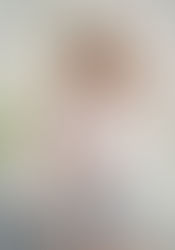 Nâng ngực có đi máy bay được không?