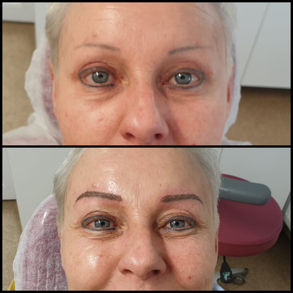 Microblading
