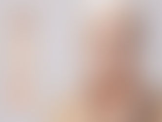 older woman touches her face where so-called age spots may occur