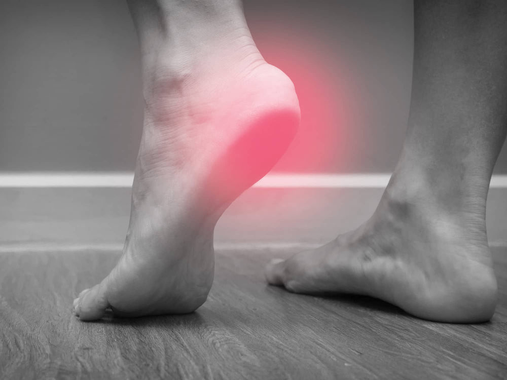 plantar fasciitis without heel pain