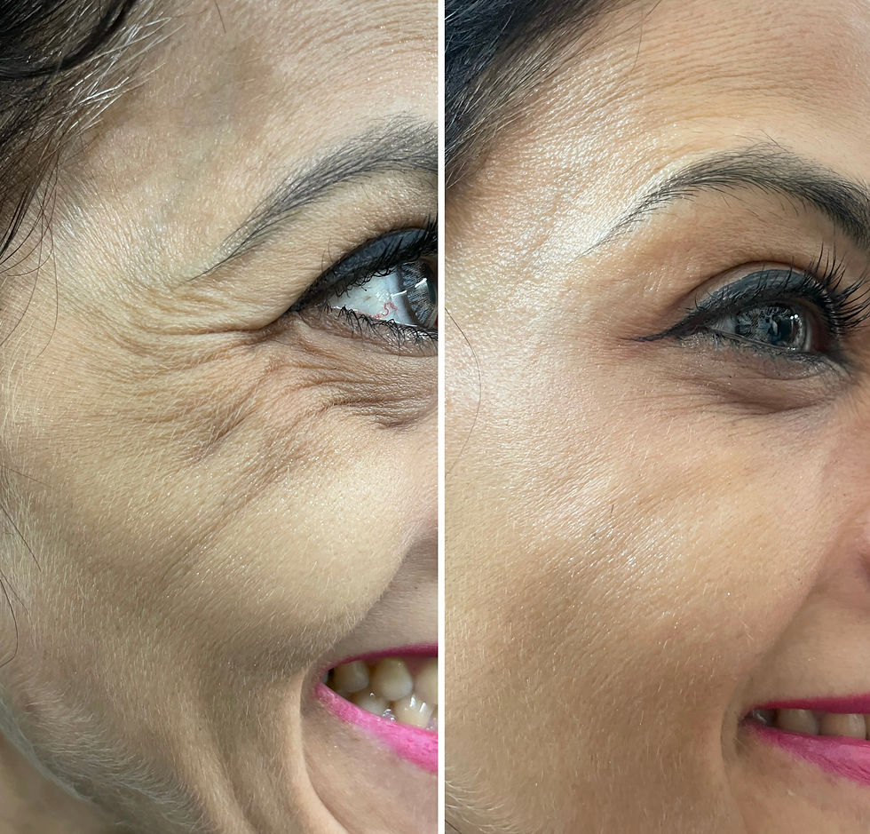 Anti Aging Treatment