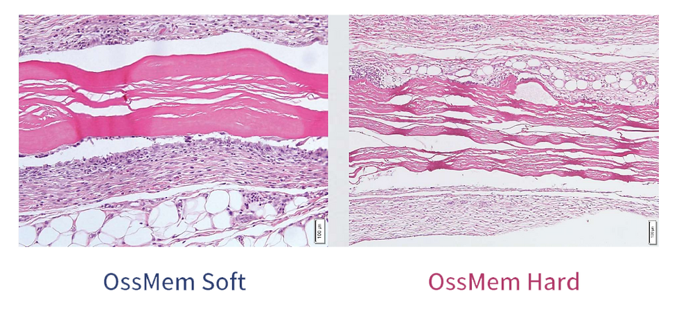 Thumbnail: Osstem OssMem