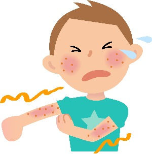 アトピー患者さんへ