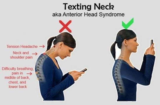 AUGUSTO MORENO - SMARTPHONES E A COLUNA CERVICAL