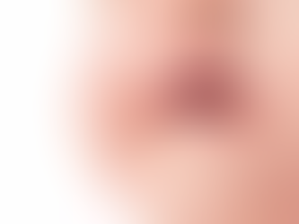 【马来西亚唇腭裂/兔唇/JB cleft lip and cleft palate手术及护理知识】在每个家长心中,宝贝都是天使!Voguestudio提供家长所能及的帮助,咨询,交流经验,欢迎私信。