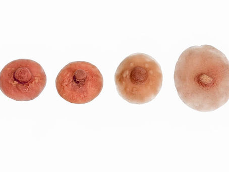 乳头美学|乳头内陷矫正|私人订制|术前评估