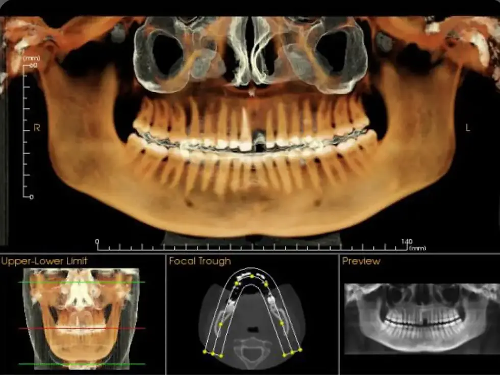 Participation Series | Hands-On CBCT Interpretation