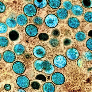 Another Epidemic After a Pandemic