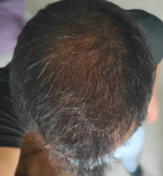 Crecimiento del Cabello