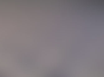 Why Pre-Settlement Legal Funding is a Smart Choice