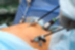 operation-stomach-medical-procedure-treating-patient-with-surgical-intervention-operating-